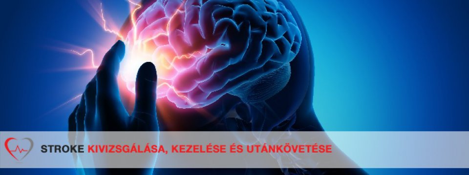 az iszkémiás stroke utáni magas vérnyomás kezelése