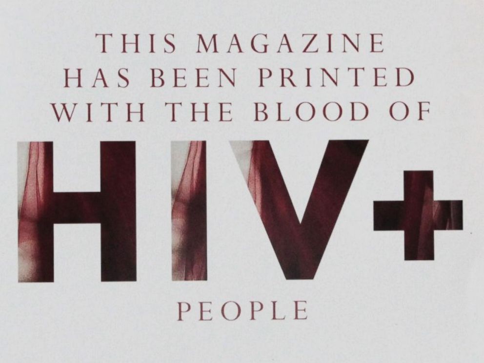 magas vérnyomás a HIV-ben)