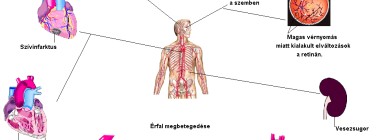 a vese magas vérnyomásának következményei)