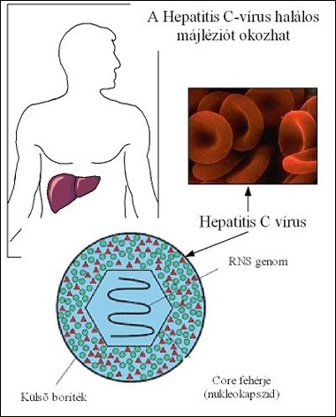 Hepatitis; májgyulladás