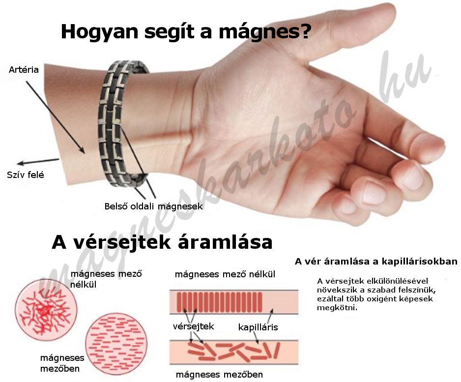 magas vérnyomás és mágnesek